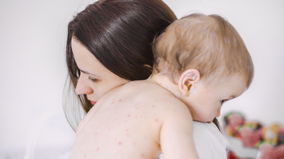How to Treat Baby Diapers Rash Efficiently?